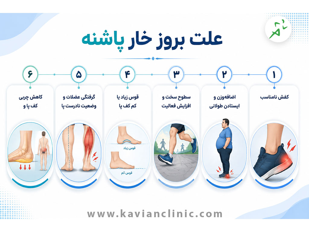 علت بروز خار پاشنه