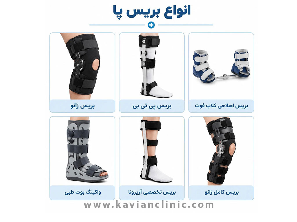 انواع بریس پا