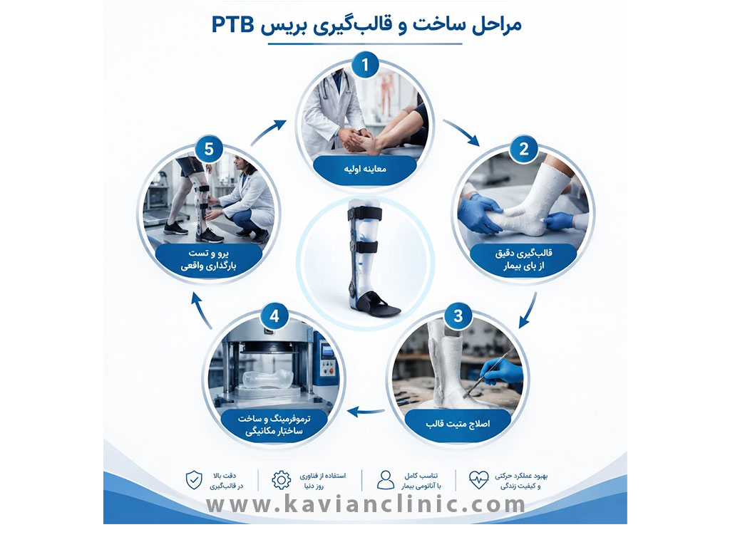 مراحل ساخت و قالبگیری بریس PTB