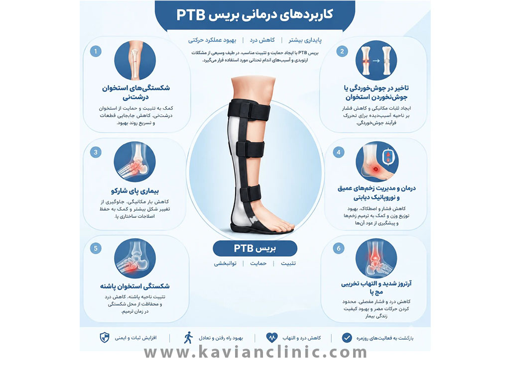 کاربردهای درمانی بریس PTB