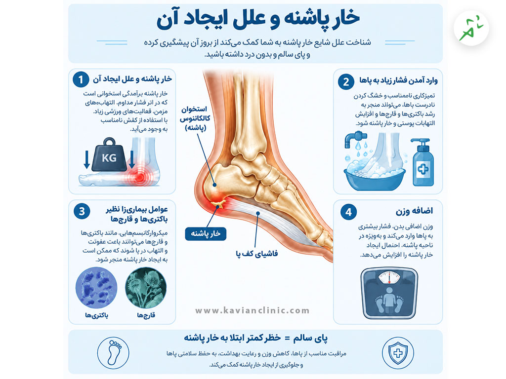 علت خار پاشنه