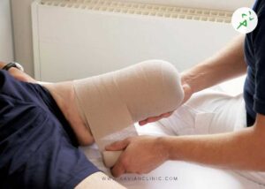 مراقبت از پای قطع شده چگونه است