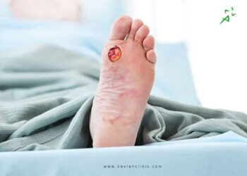 پانسمان زخم دیابت و نحوه شستشو و پانسمان زخم دیابتی چگونه است