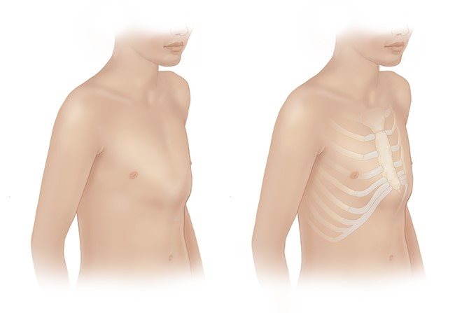 سینه کفتری