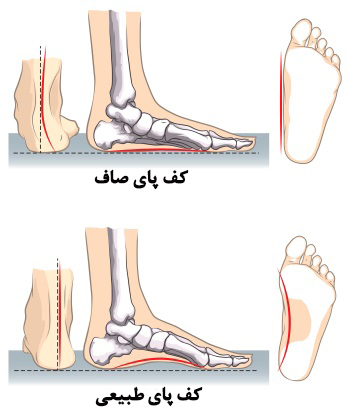 صافی کف پا