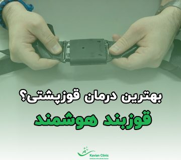 ویدیو نحوه بستن قوز بند هوشمند