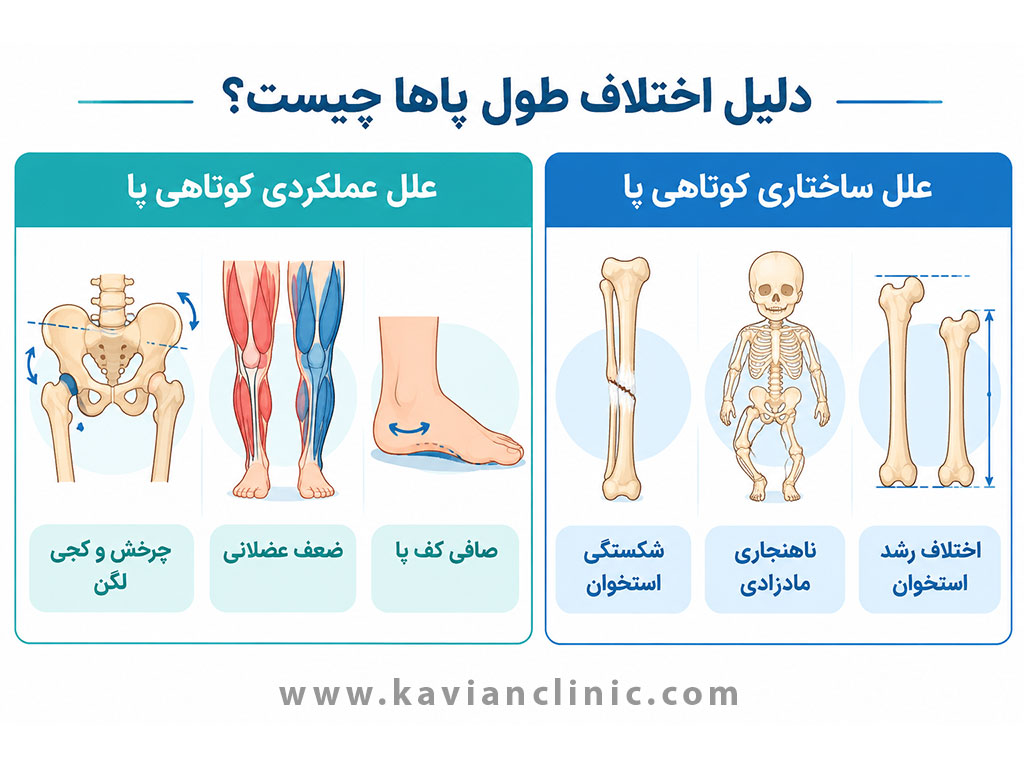 دلیل اختلاف طول کف پا