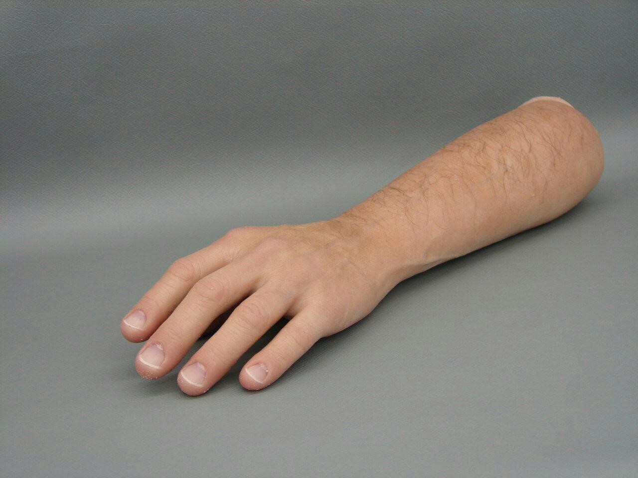 قطع دست