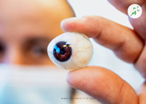 پروتز چشم اوکولار، بررسی ویژگیها و کاربرد آن