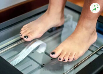 هزینه اسکن کف پا در سال 1404 عوامل موثر بر قیمت اسکن کف پا