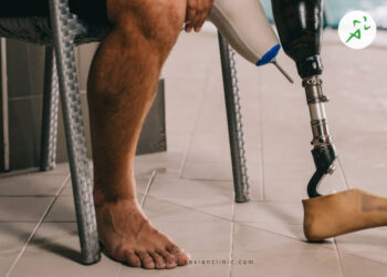 راهنمایی خرید پروتز پا