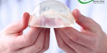 معرفی بهترین برند پروتزهای سینه