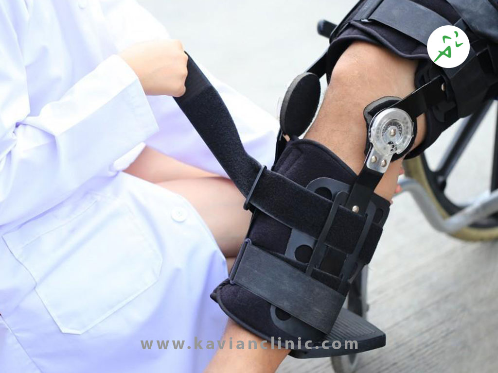 بریس آماده بهتر است یا سفارشی؟