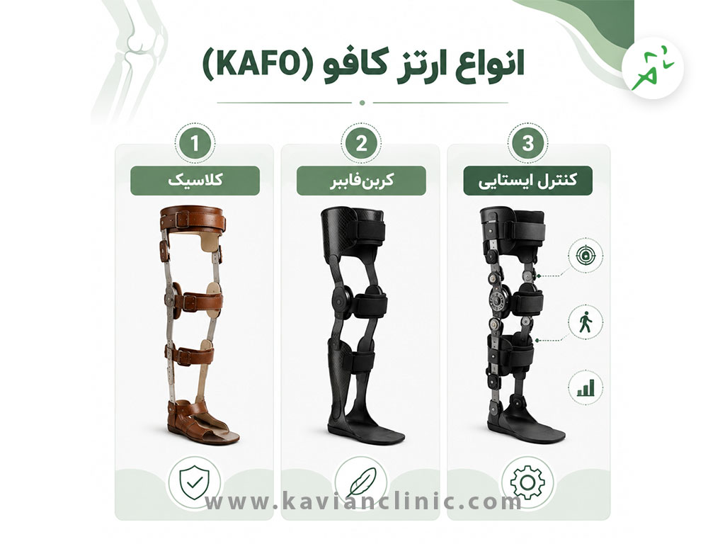 انواع ارتز کافو