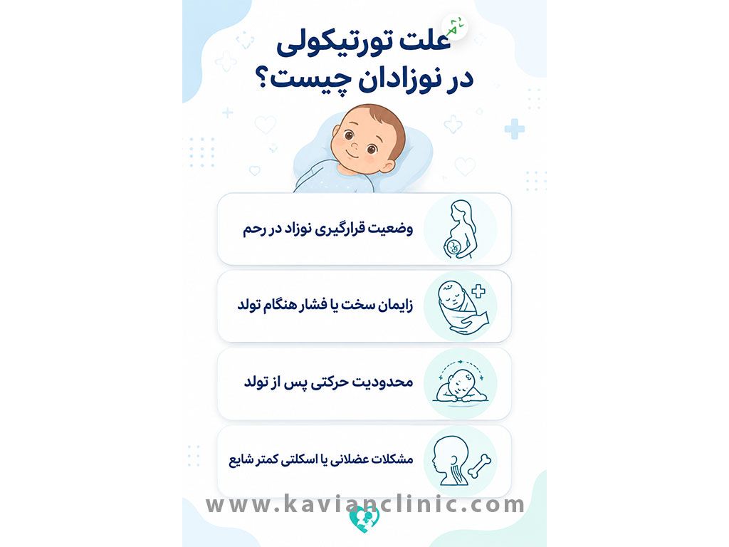 علت تورتیکولی در نوزادان چیست؟